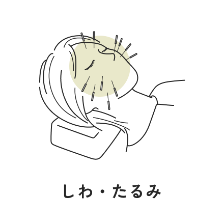 シワ、たるみ